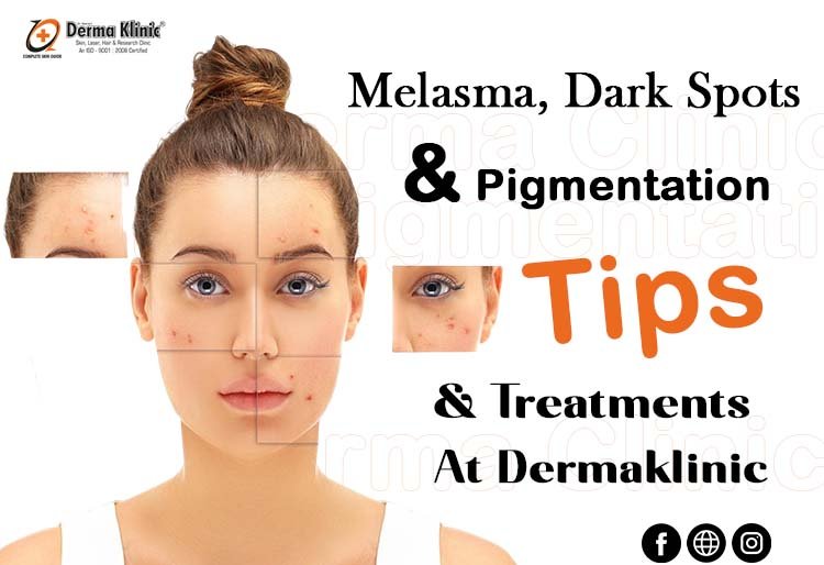 Female Hair Fall Treatment in Lucknow: Say Goodbye to Hair Loss with The Derma Klinic