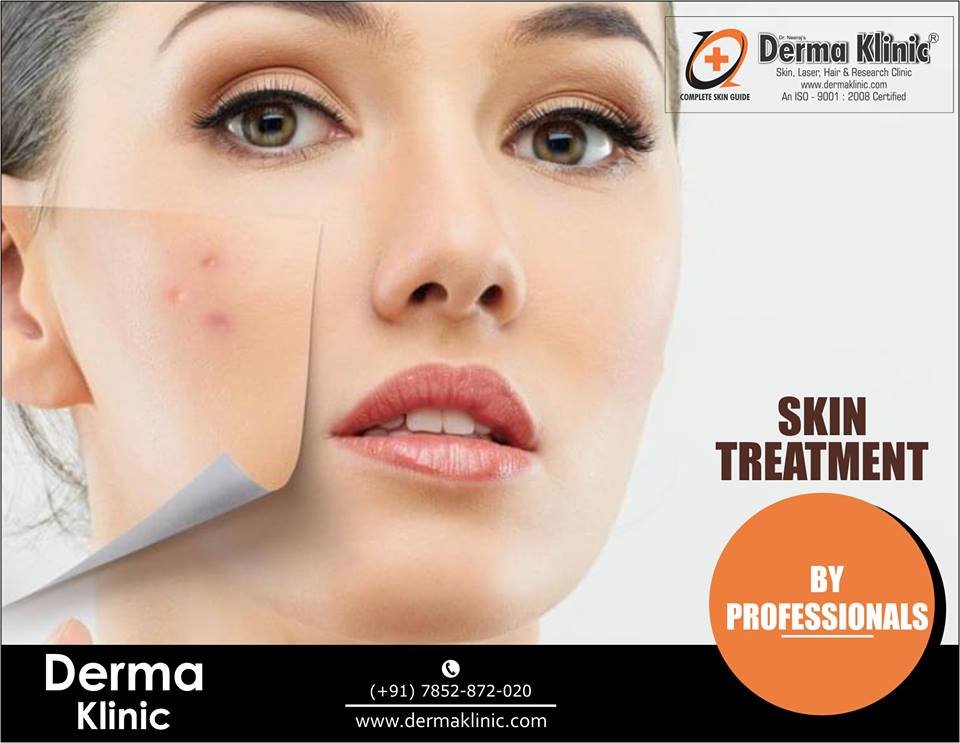 Laser Skin Treatment in Hazratganj 