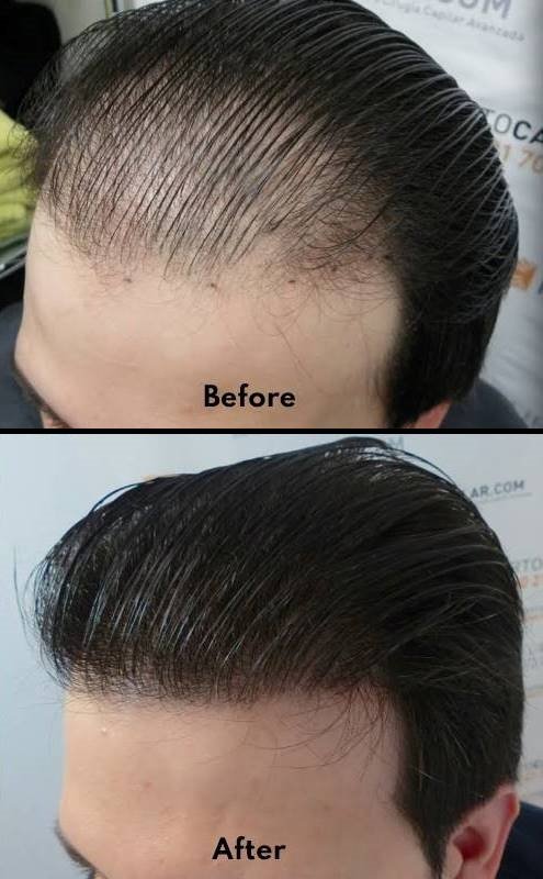 Derma Klinic | Hair transplant in lucknow Derma Klinic | Hair transplant in lucknow
