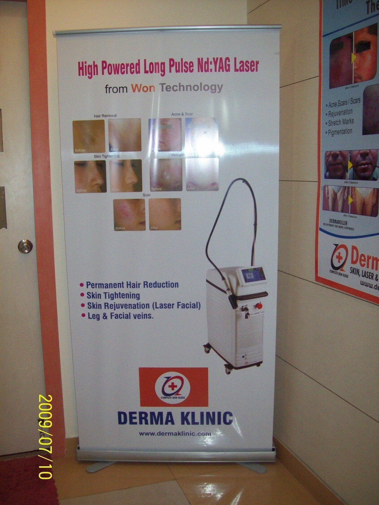 Laser Hair Reduction In Lucknow