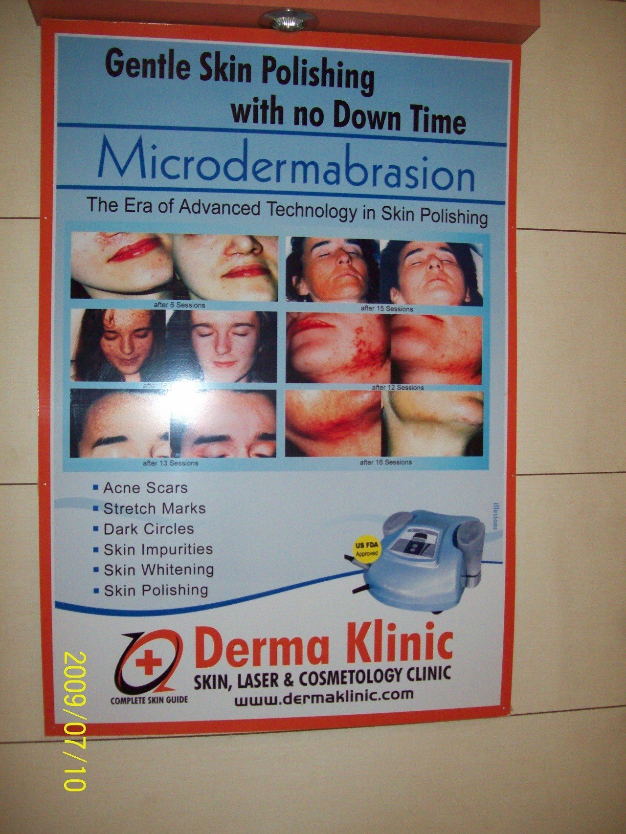 Laser tattoo Removal in lucknow