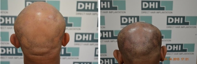 Derma Klinic Dermatologist in Lucknow