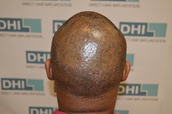 Derma Klinic Dermatologist in Lucknow