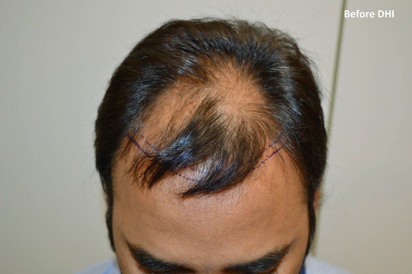 Derma Klinic Dermatologist in Lucknow