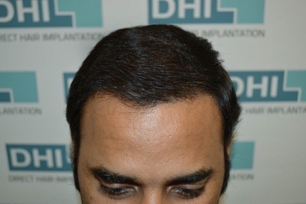 Derma Klinic Dermatologist in Lucknow