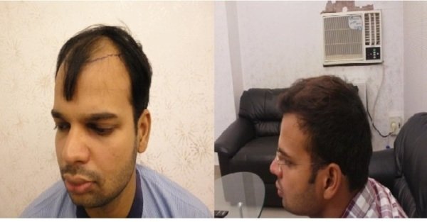 Derma Klinic Dermatologist in Lucknow