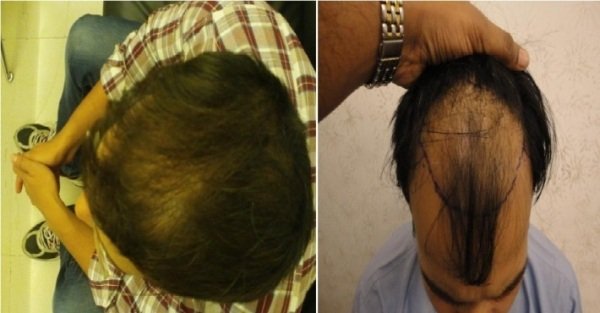 Derma Klinic Dermatologist in Lucknow