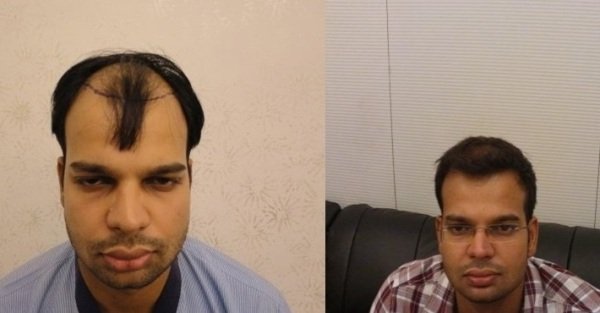 Derma Klinic Dermatologist in Lucknow